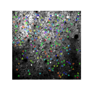 Cell Segmentation